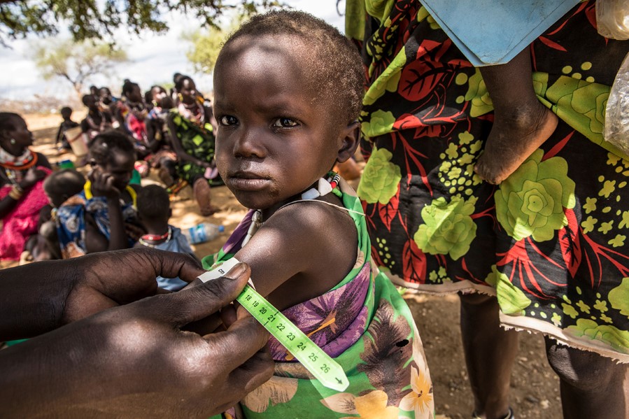 WFP/Gabriela Vivacqua  2019, Child, Distribution, Gabriela Vivacqua, May, MUAC, South Sudan, WFP, WFP/Gabriela Vivacqua